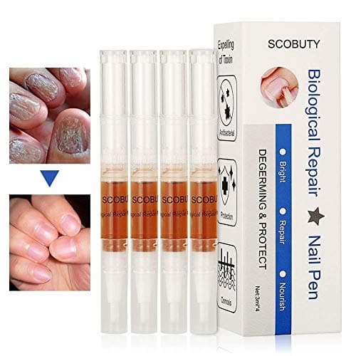 Toenail Fungus Treatment, Fungus Stop, Toenail Antifungal Care, Nail Fungus Treatment pen, Fungal Nail Gel, Anti Fungus Nail Treatment, Nail Fungus Solution Effective against nail fungus