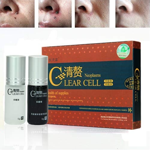 Wart, Mole and Skin Tag Remover with Skin Rejuvenation Essence by U-Style