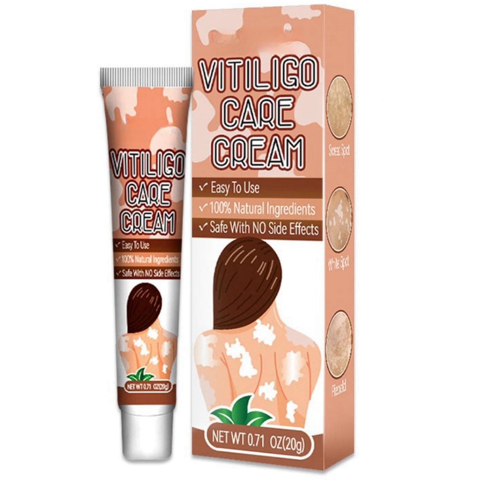 Vitiligo Care Cream 20g, Vitiligo-Specific Formula Skin-Pigmentation Enhancement, Nourishes and Moisturizes, Sun Protection, Soothes Itchy and Irritated Skin, Suitable for Various Body Areas