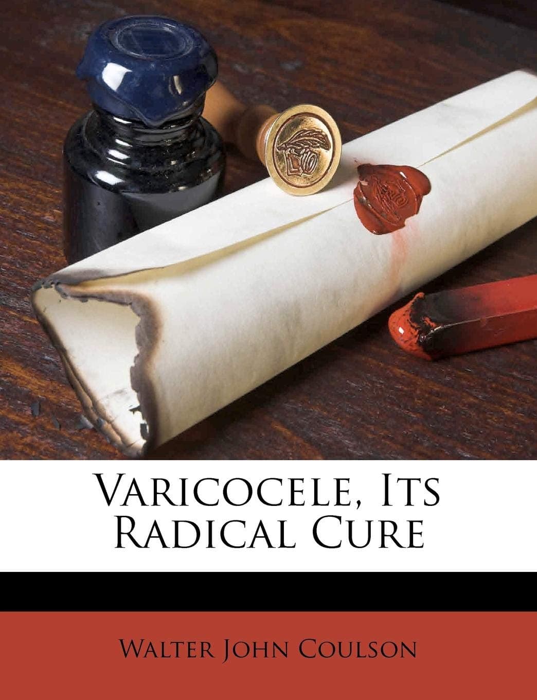 Varicocele, Its Radical Cure Paperback – May 15, 2012
