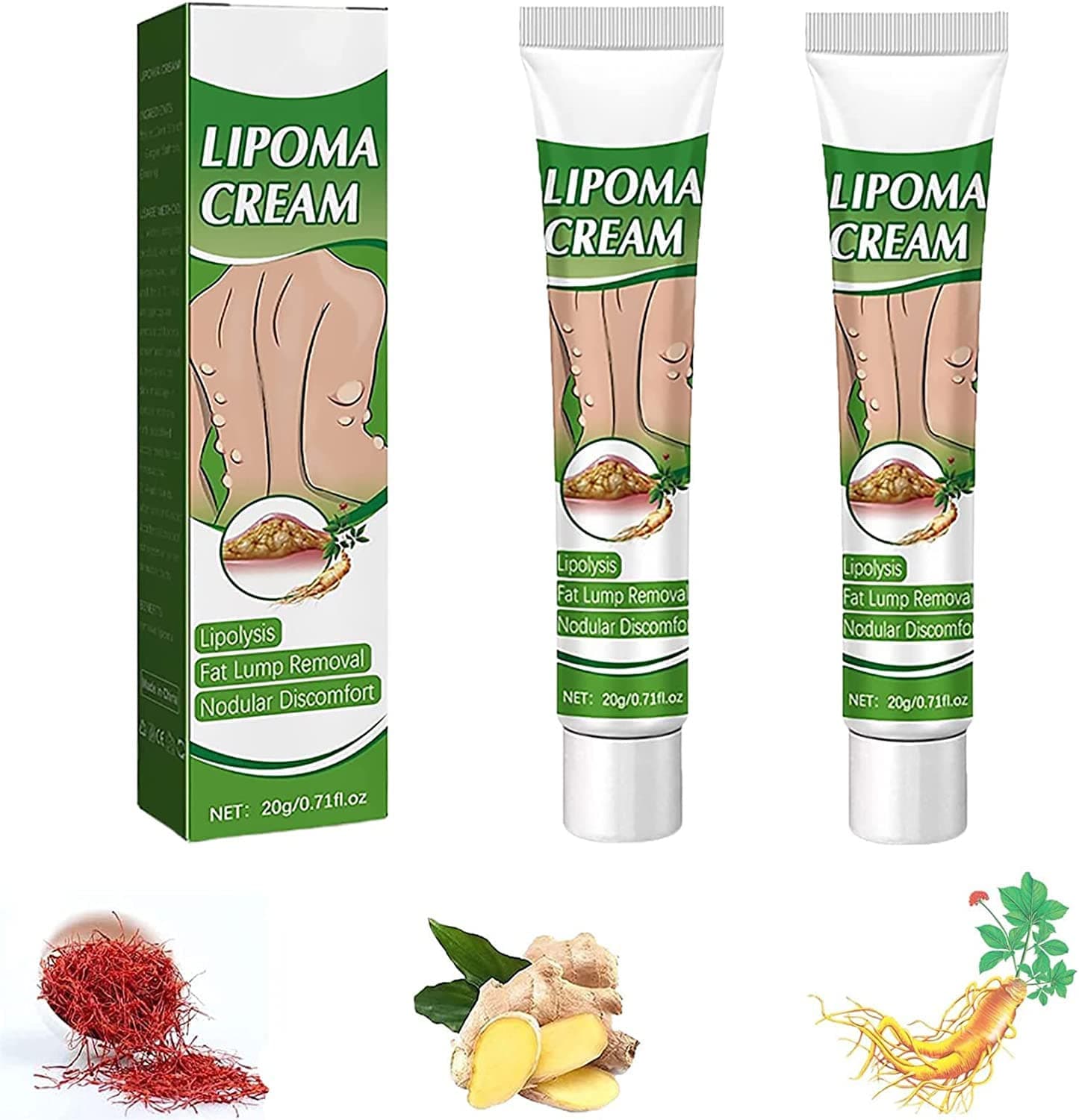 LipomaCure Soothing Ointment,LumpFree Lipoma Removal Cream,Herbal Lipoma Lumps Removal Cream,Get Rid of Your Fatty Lipoma Lumps (2 Pcs)