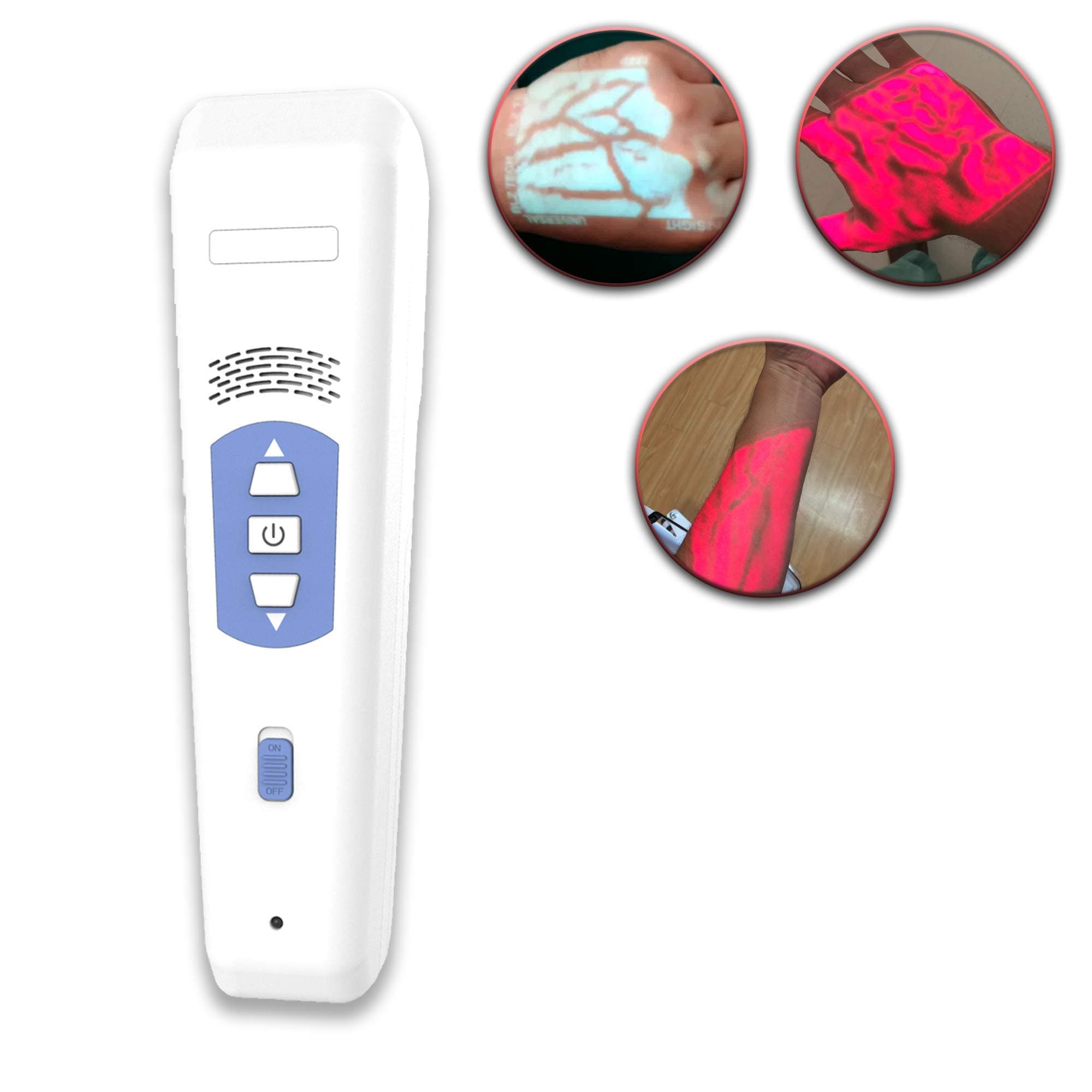 Vein Finder for IV Portable Vein Viewer Device - Infrared Vein Transilluminator/Illuminator for Nurses EMS Phlebotomy