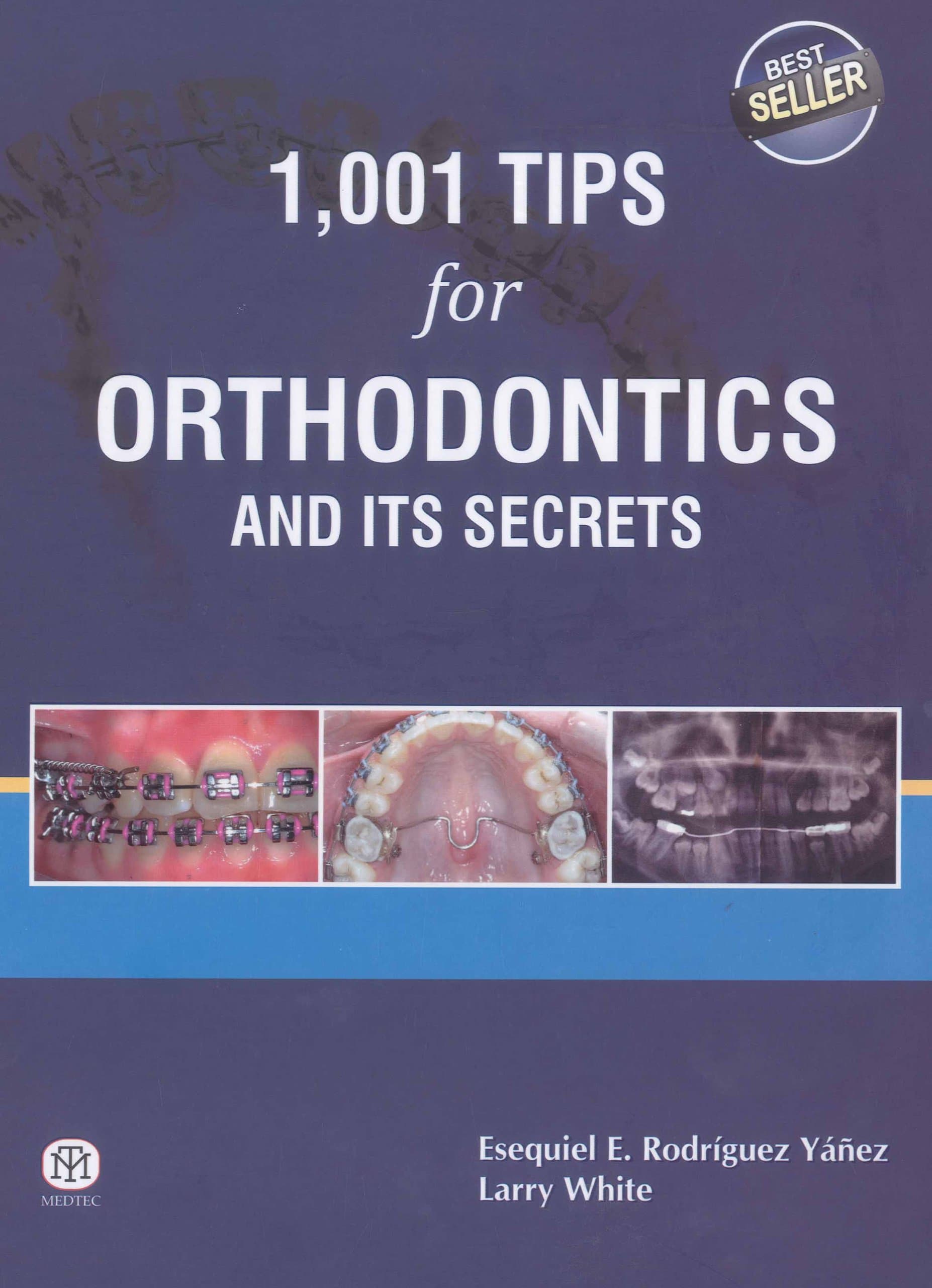 1,001 Tips for Orthodontics and its Secrets Hardcover – March 15, 2013