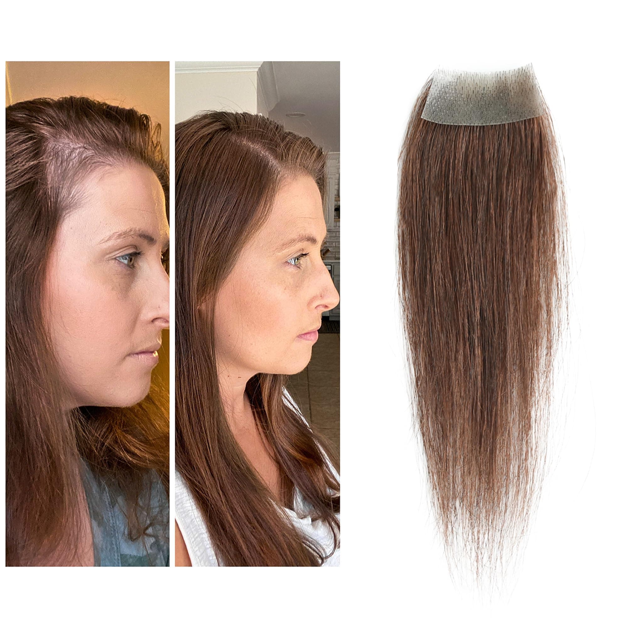 scar human hair replacement Accidental burns without hair for men women Hairline Loss Straight Tape in Replacement Toupee (Medium Brown, 0.78"x1.5")