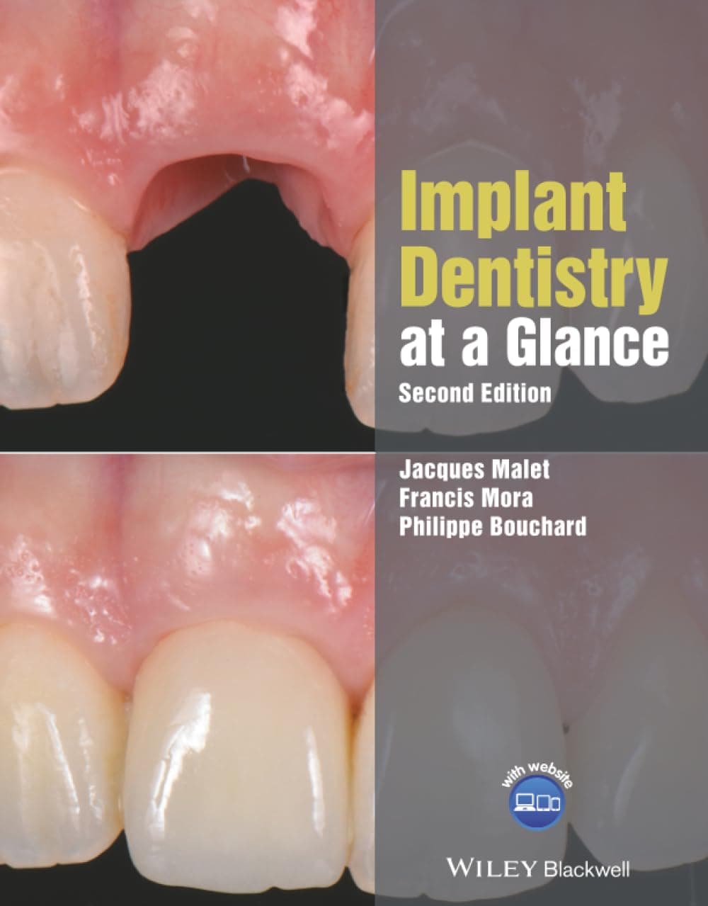 Implant Dentistry at a Glance, 2nd Edition