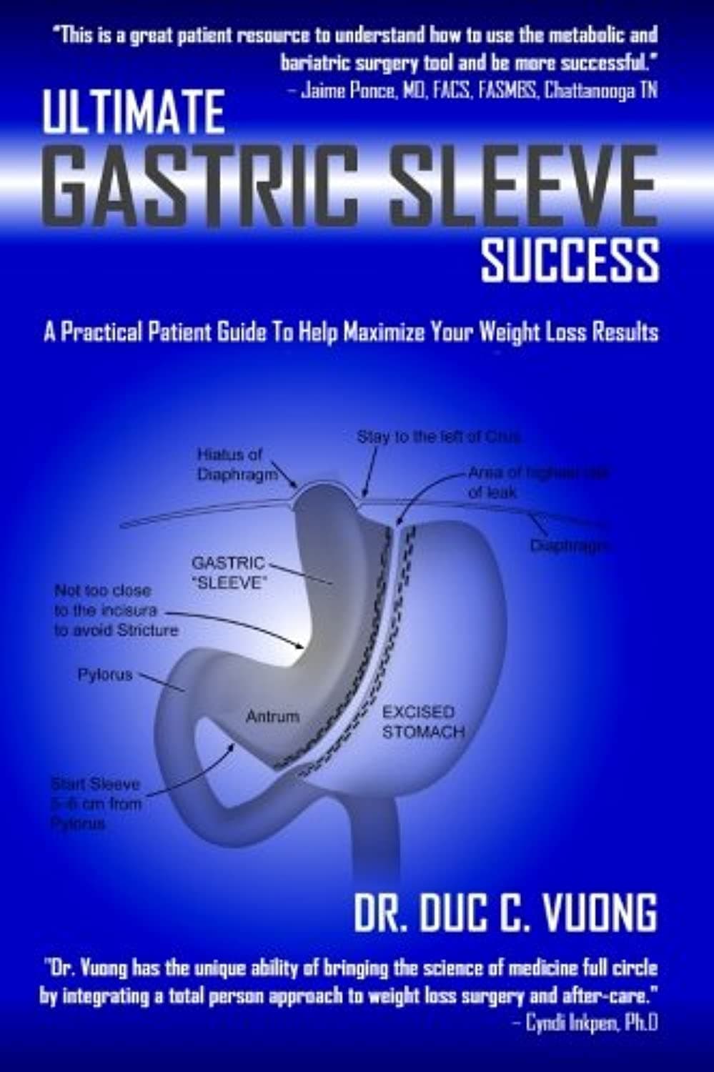 Ultimate Gastric Sleeve Success: A Practical Patient Guide To Help Maximize Your Weight Loss Results Paperback – June 21, 2013