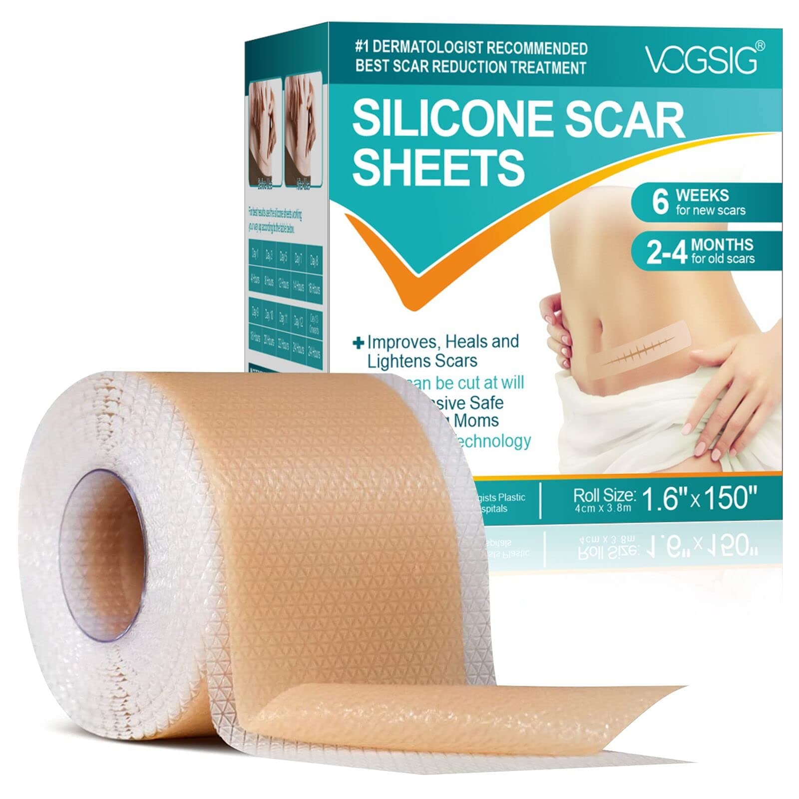 Silicone Scar Sheets (1.6” x 150”-3.8M), Medical Grade Soft Silicone Scar Tape, Strips, Roll - Keloid, C-Section, Surgical, Acne- Scars Removal Treatment, Painless Easy Removal, Reusable